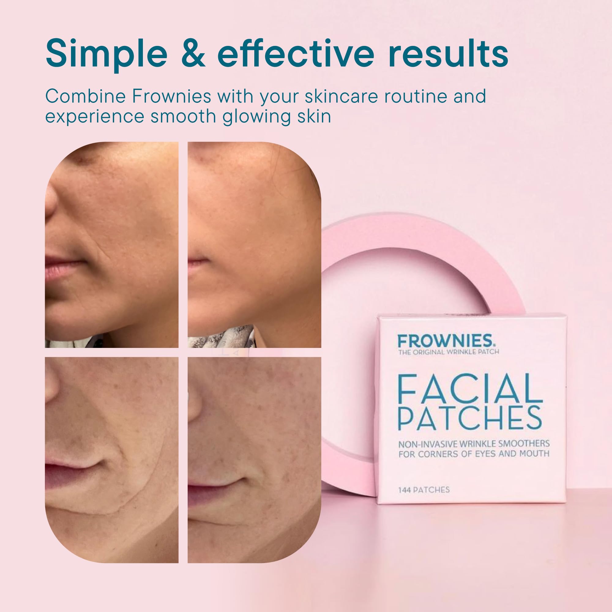 Frownies Facial Patches for Corner of Eyes & Mouth - Anti-Wrinkle Face Tape for Crow's Feet & Smile Lines - Hypoallergenic Overnight Wrinkle Patches (144 Count)