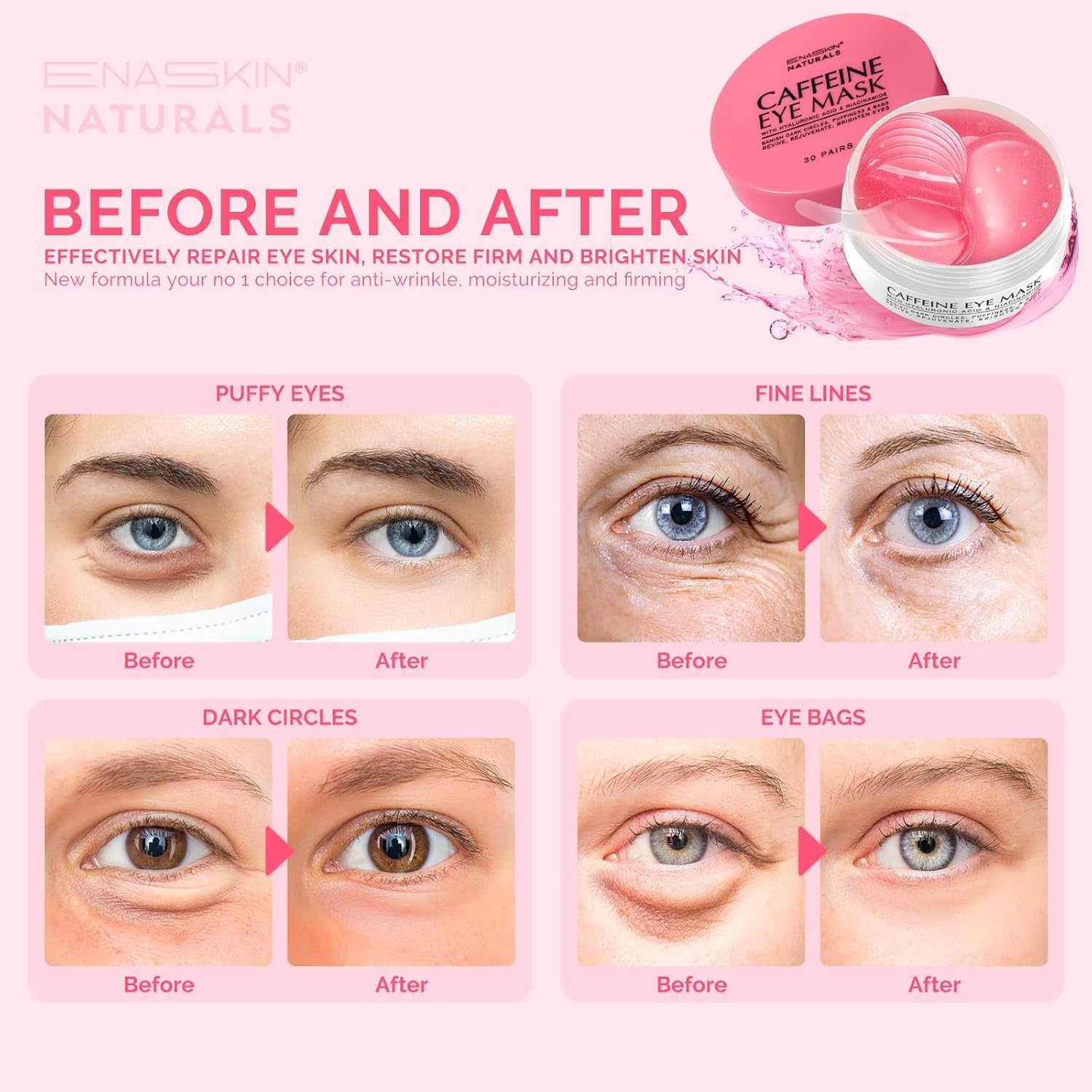 Under Eye Patches Kit - 120 Pcs Retinol & Caffeine (2 Pack)