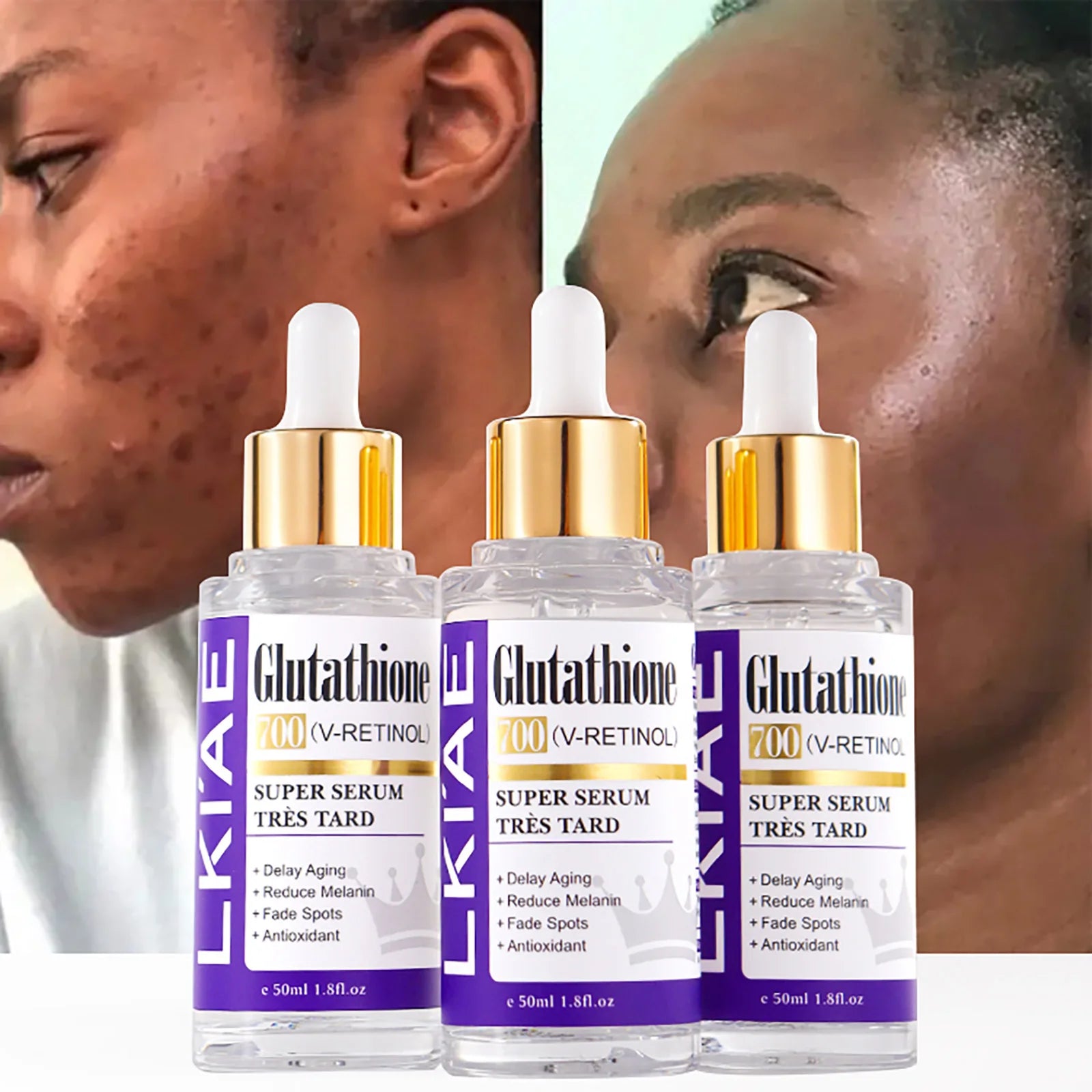 Three bottles of LKAE Glutathione serum with close-up shots of a woman's face with skin issues.